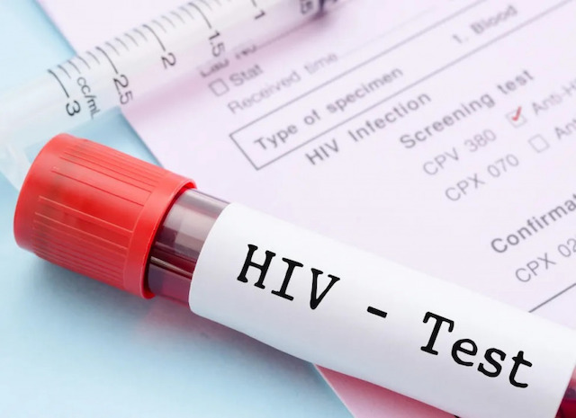 2021年の新規HIV感染者報告数は昨年よりさらに減少【g-lad xx】